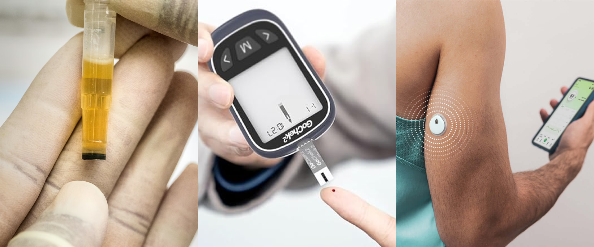 Evolution of Glucose Monitoring: From Fingersticks to CGMS