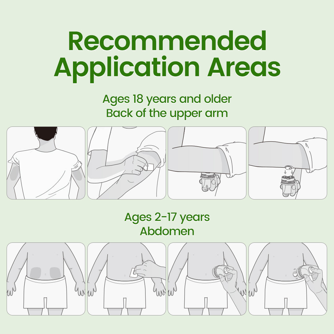 LinX Vista Continuous Glucose Monitoring System